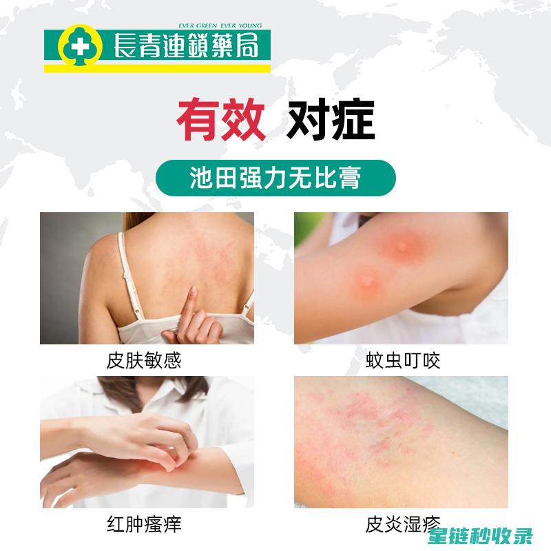 蚊虫叮咬止痒秘籍，让你轻松止痒 (蚊虫叮咬止痒最有效的药)